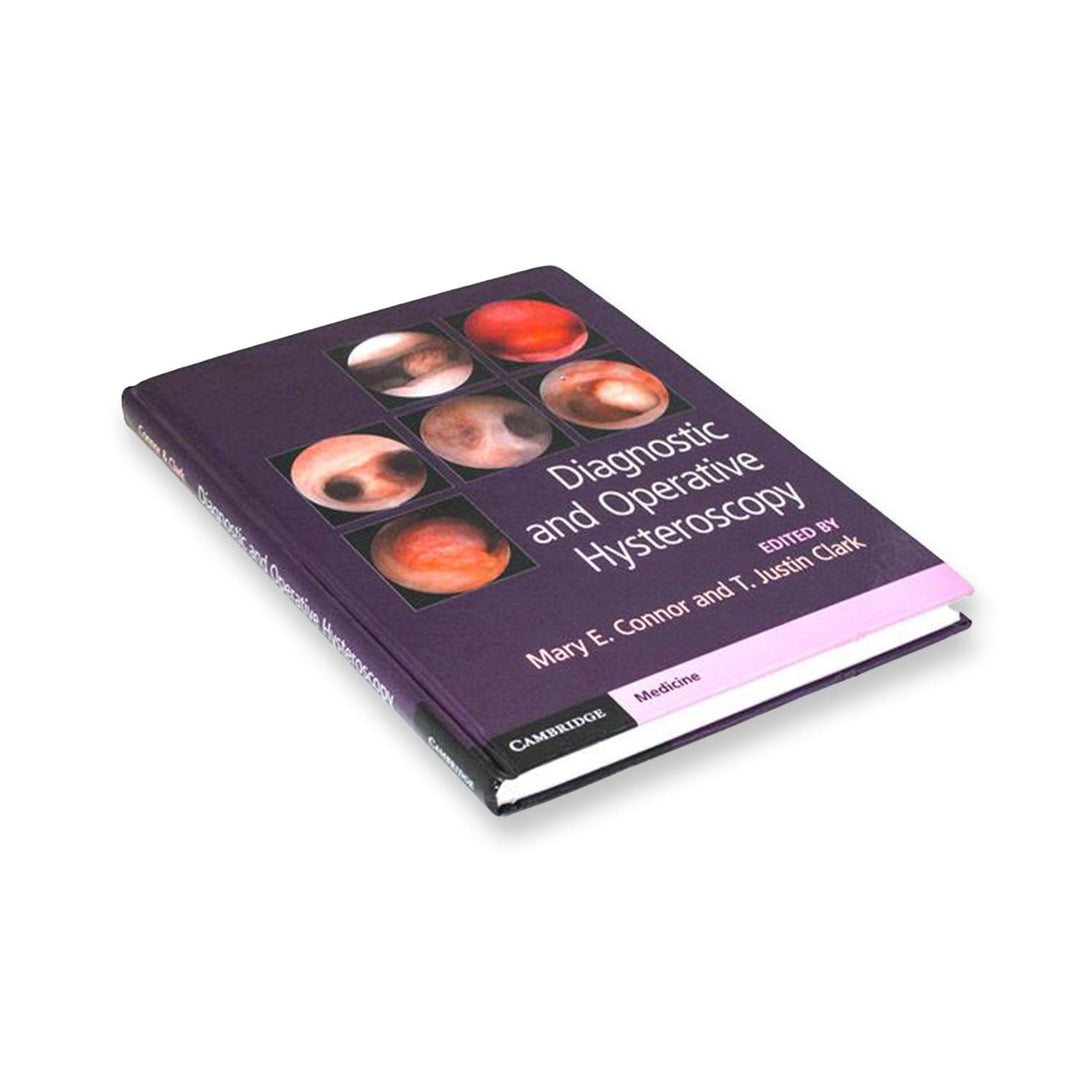 Diagnostic And Operative Hysteroscopy - Hardcover | 9781107111608